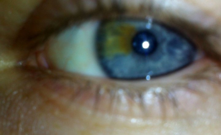 Mon oeil :D