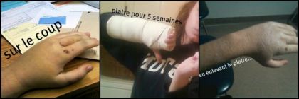 Avec tout ça, même pas encore guéri, un autre 3 semaines dans le...