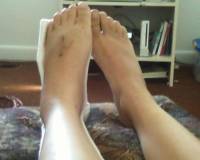 Dans l 'oeuil     ayoye ! 
je trouve que jai ete quand meme chanceuse que sa ne sois pas sur ma jambe et rien que sur le pied     & moi aussi j...