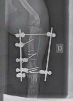 Mon chien: double fracture ouverte du tibia